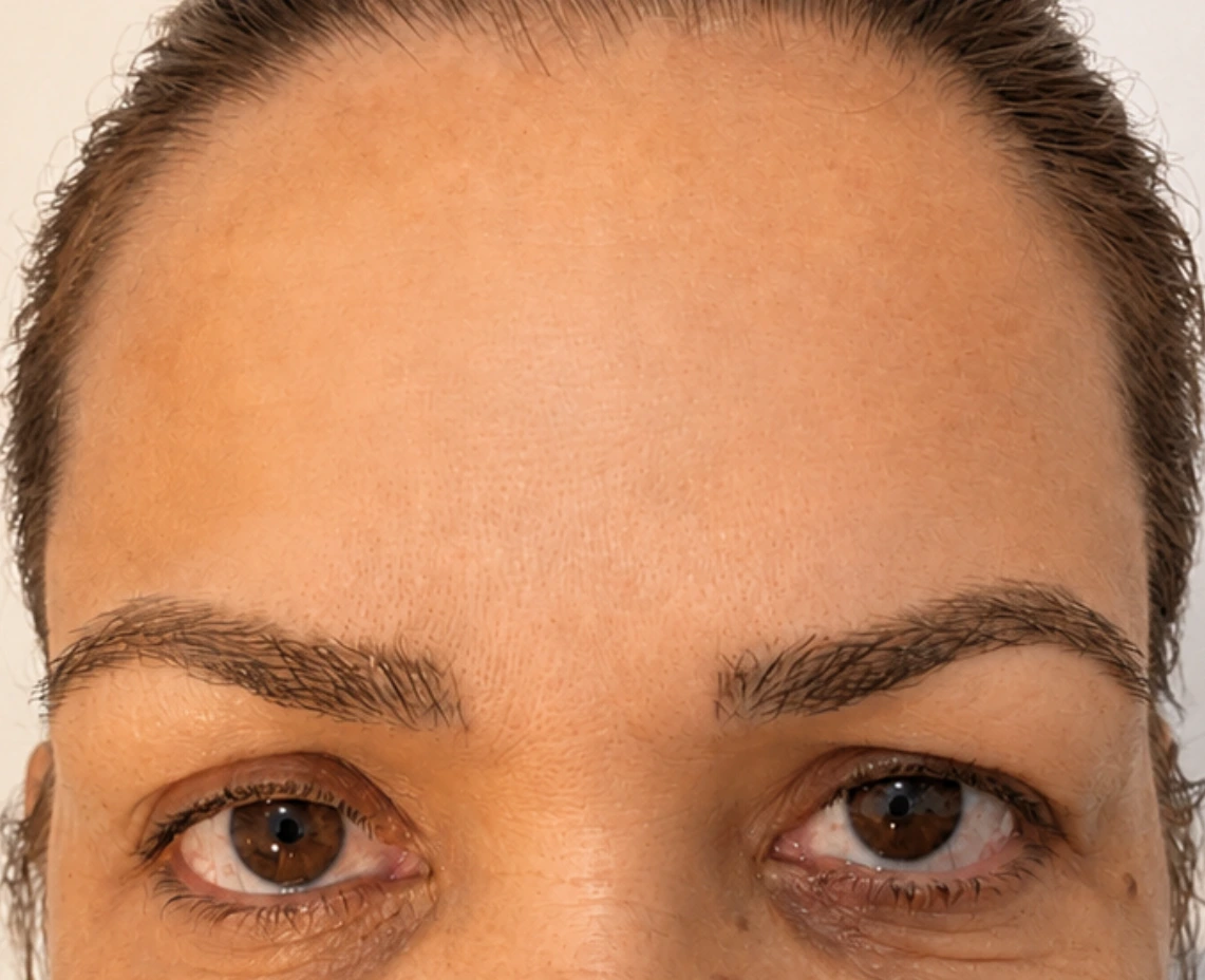 Depois da estética facial
